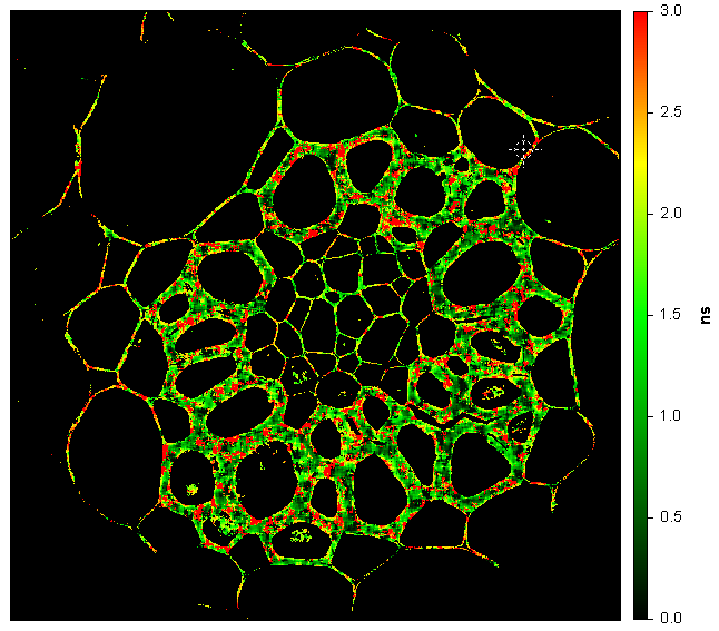 Convallaria (lily of the valley) fluorescence lifetime image