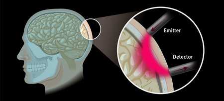 Light penetration in brain tissue