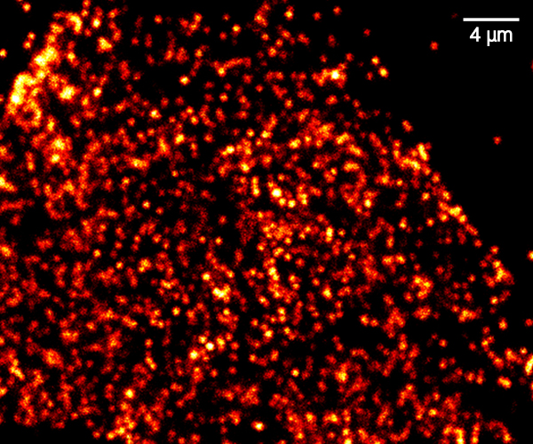 Confocal image of HSV1