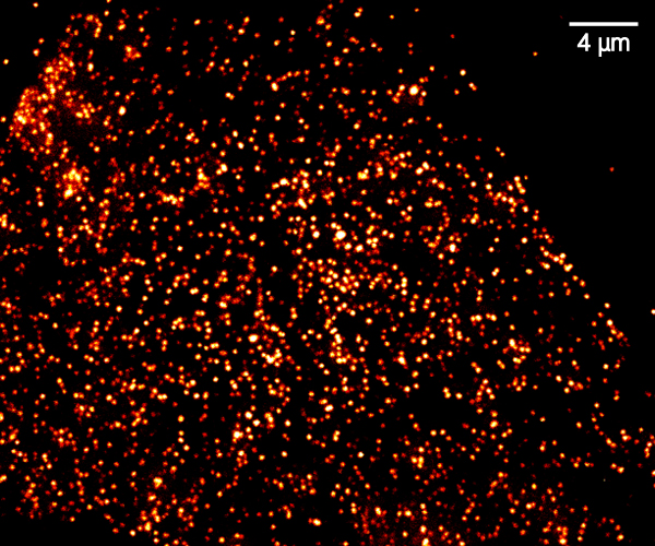 pSTED image of HSV1