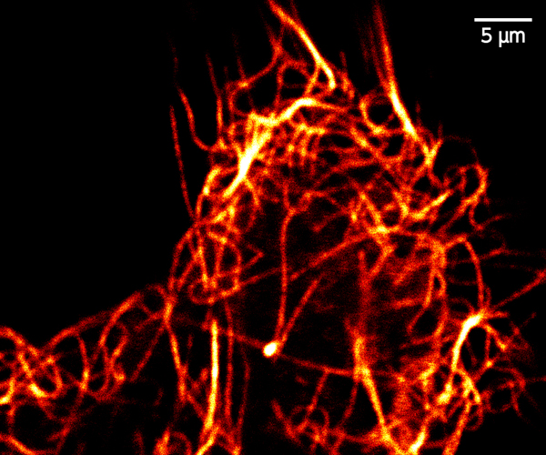 Confocal image of microtubule in HeLa cell