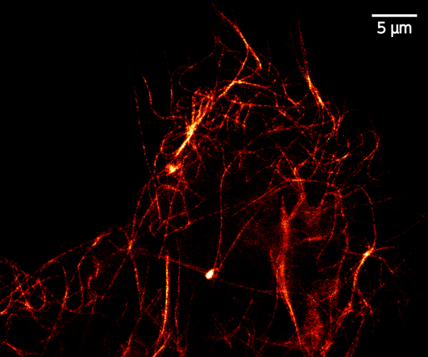 pSTED image of microtubule in HeLa cell