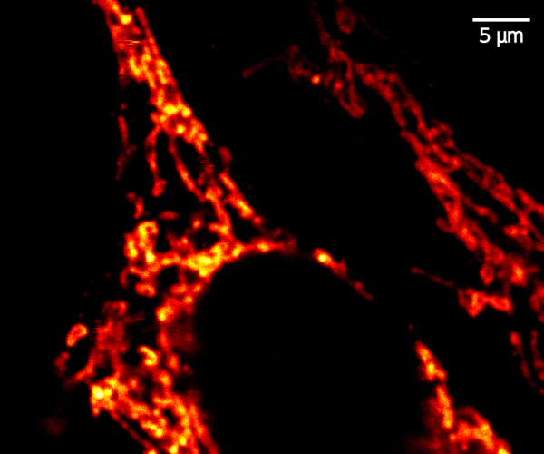 Confocal image of mitochondria in HeLa cells