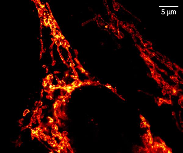 pSTED image of mitochondria in HeLa cells