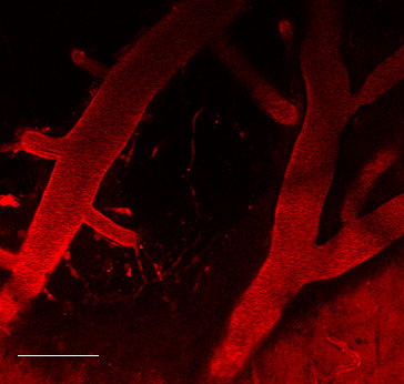 2-photon image of the mouse brain surface vasculature using 70kD Texas Red dextran dye