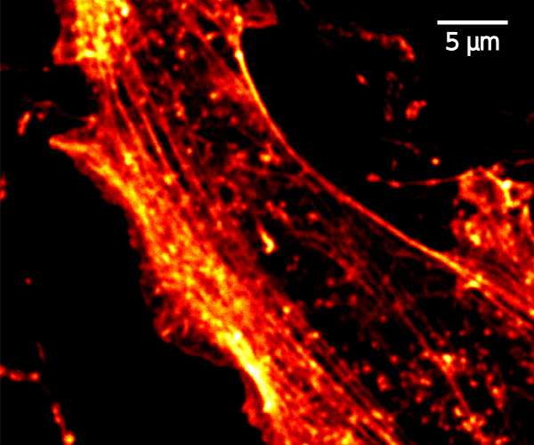Confocal image of actin in neurons
