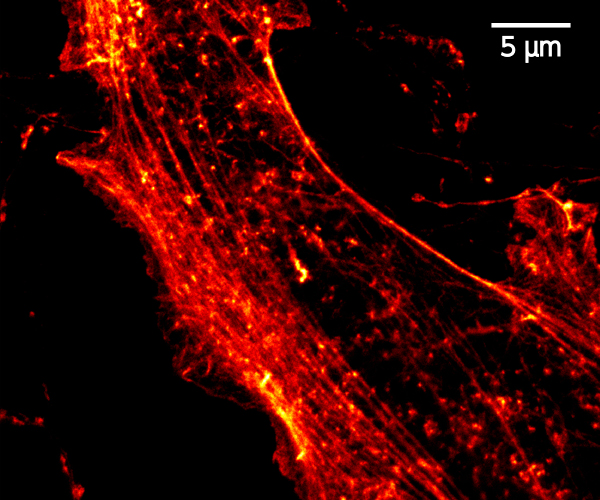pSTED image of actin in neurons
