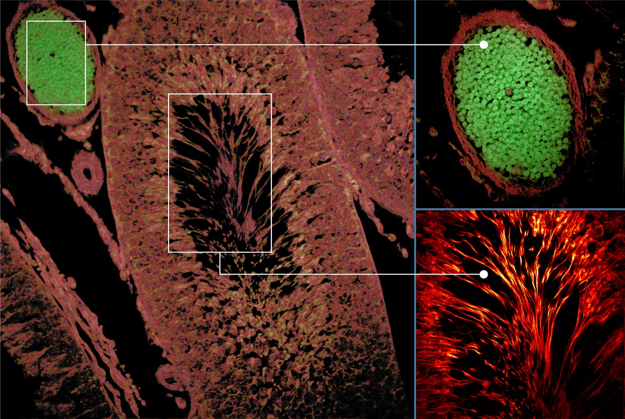 Autofluorescence tissue image